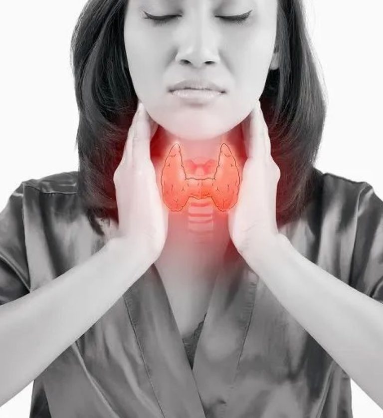 Woman holding her throat showing the thyroid gland, illustrating the link between Hashimoto's and blood sugar